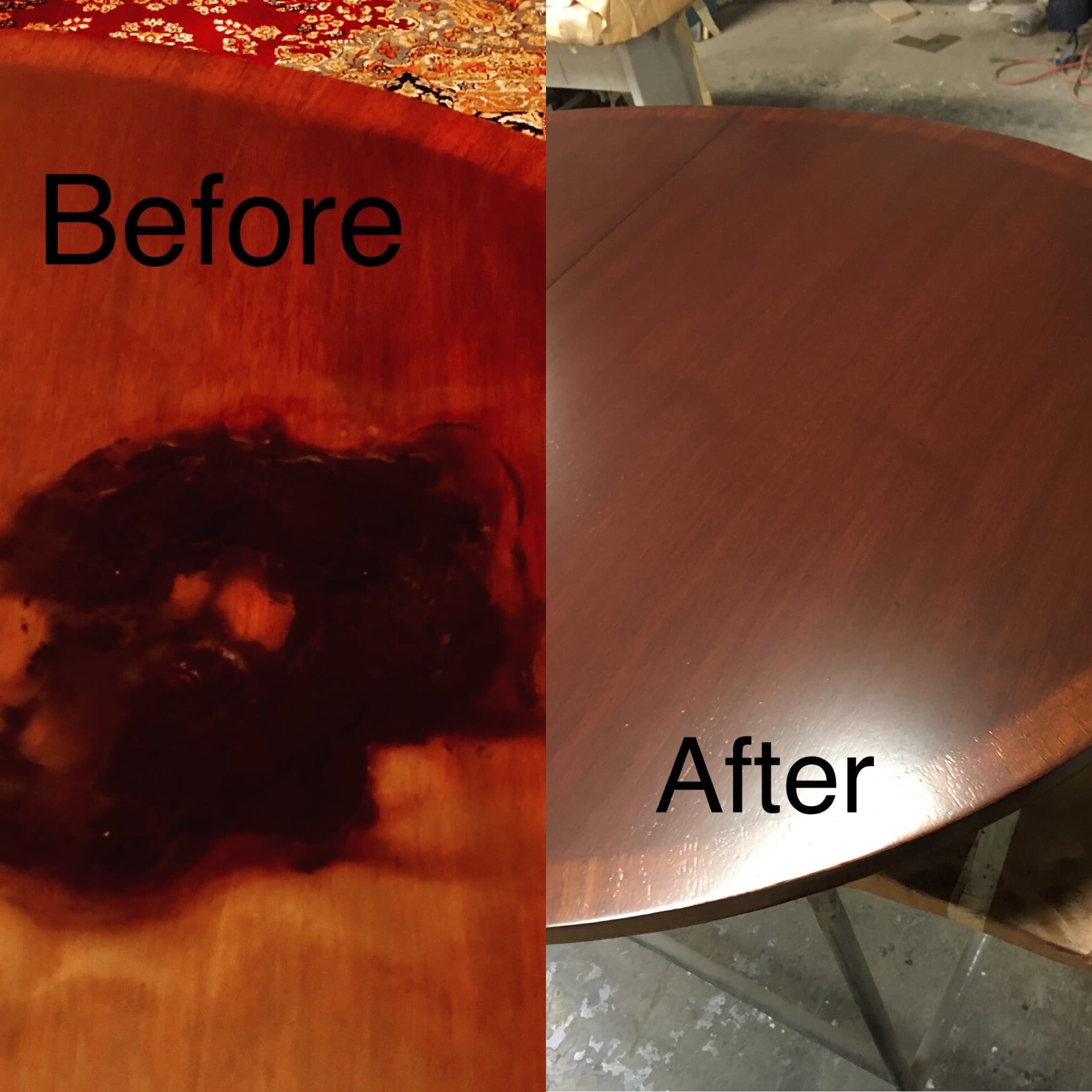Veneer restoration detail